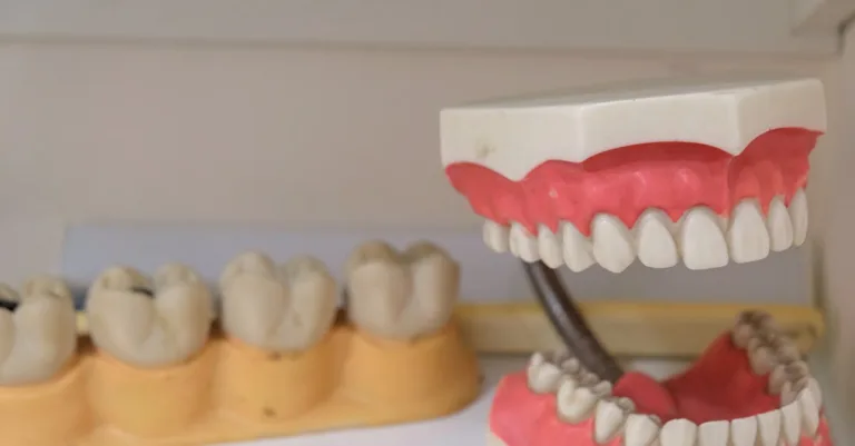 découvrez notre système de céramique dentaire alliant esthétisme et durabilité pour des restaurations dentaires parfaites et naturelles.