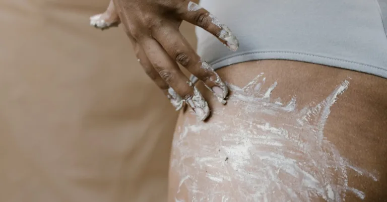 tout savoir sur la cellulite : définition, causes, traitements efficaces et conseils pour la prévenir et l'atténuer naturellement.
