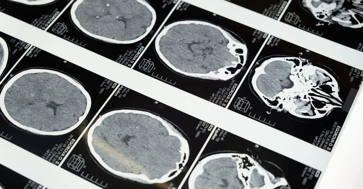 découvrez les anomalies observées lors d'un examen irm sous stress, une technique avancée pour évaluer la fonction cardiaque et détecter les troubles cardiovasculaires.
