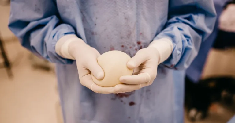 informations essentielles sur le lipome : définition, symptômes, causes et options de traitement pour cette masse graisseuse bénigne sous la peau.