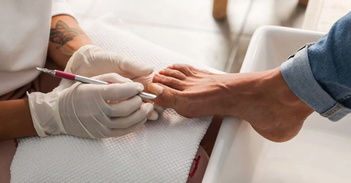 découvrez les causes des ongles d'orteils jaunes, leurs symptômes et les solutions pour retrouver des ongles sains et éclatants.