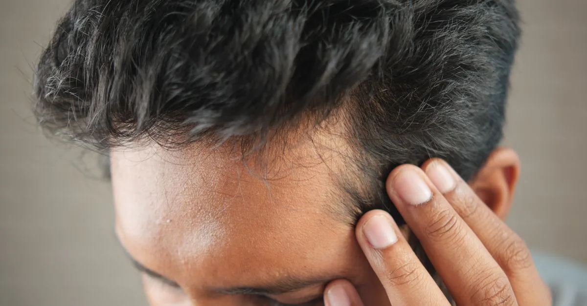 découvrez des conseils et solutions efficaces pour lutter contre la perte de cheveux et retrouver une chevelure plus dense et saine.